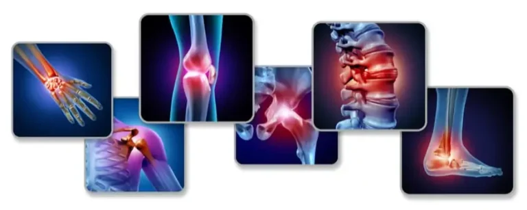What is Joint Stiffness? (जोड़ो की अकड़न क्या है?)
