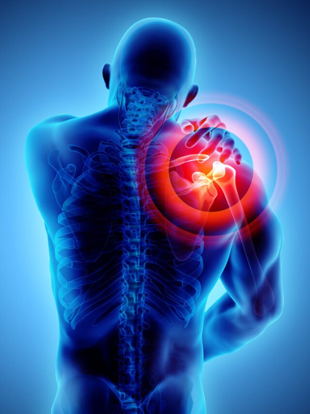Shoulder painful skeleton x-ray, 3D illustration.
